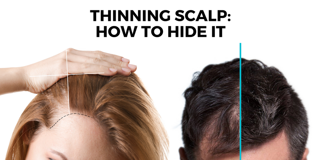 How to conceal my scalp if I have thinning hair?