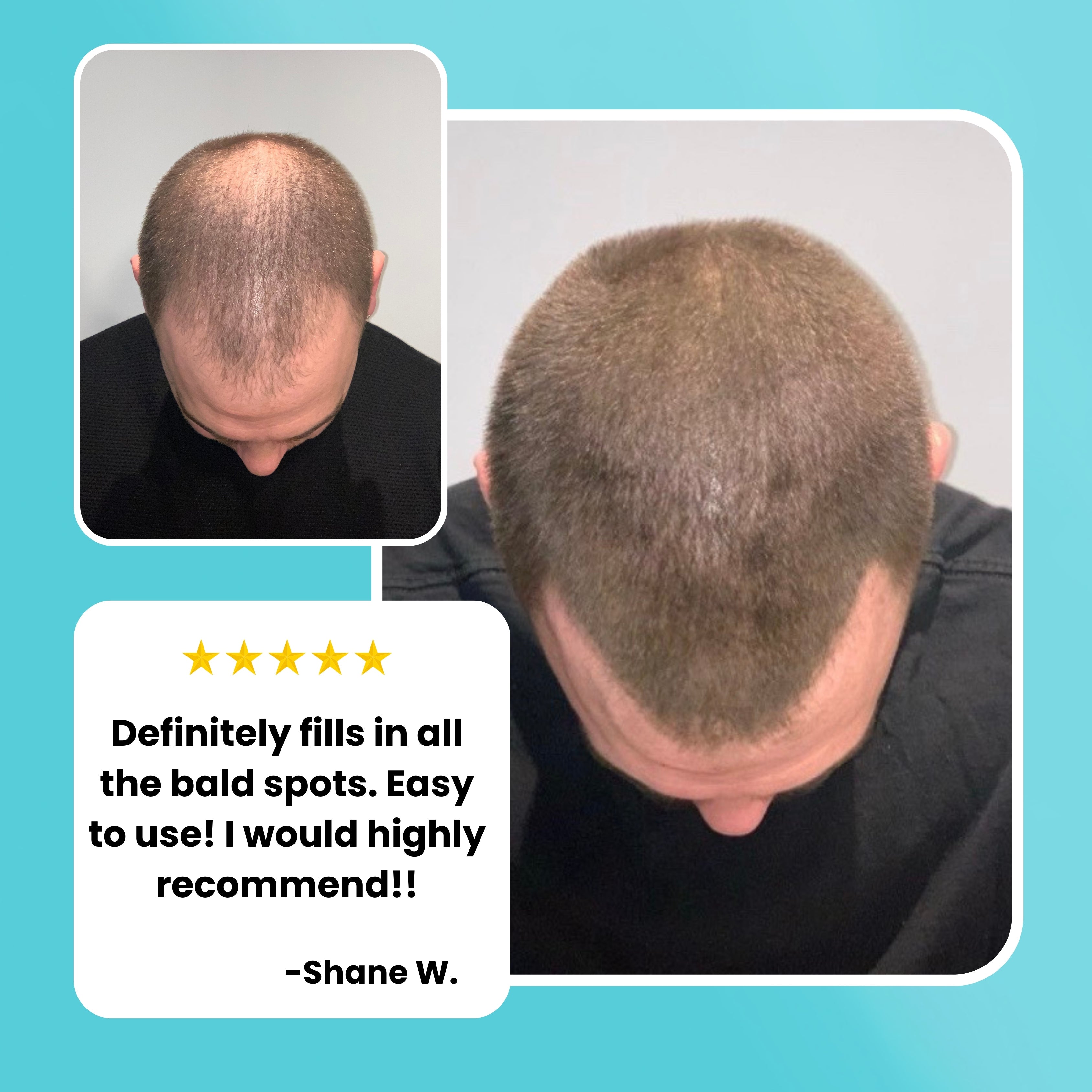 Hair Thickening Fibers (15g) + Application Tools (11% SAVINGS)