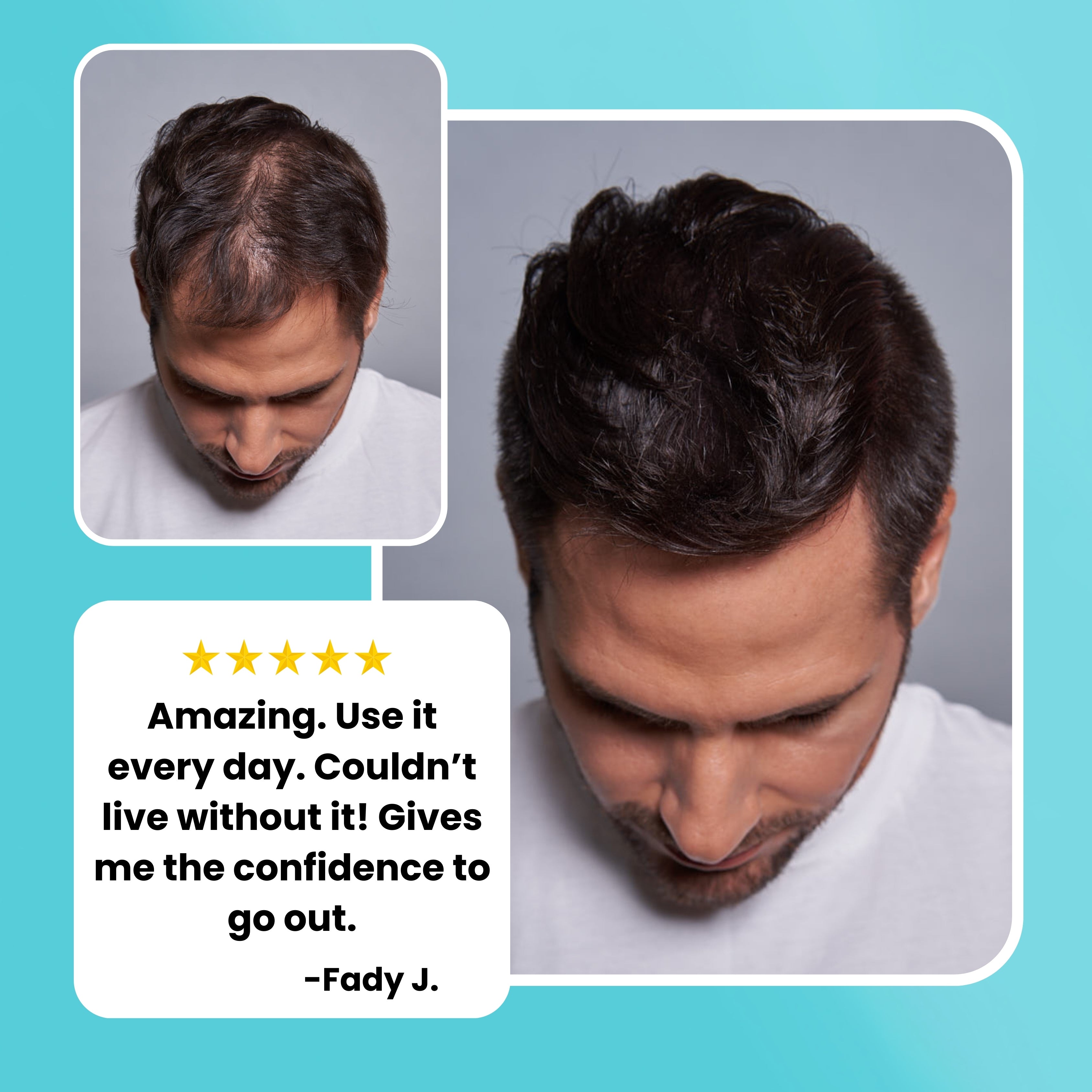 Hair Fiber Starter Package (8% Savings)