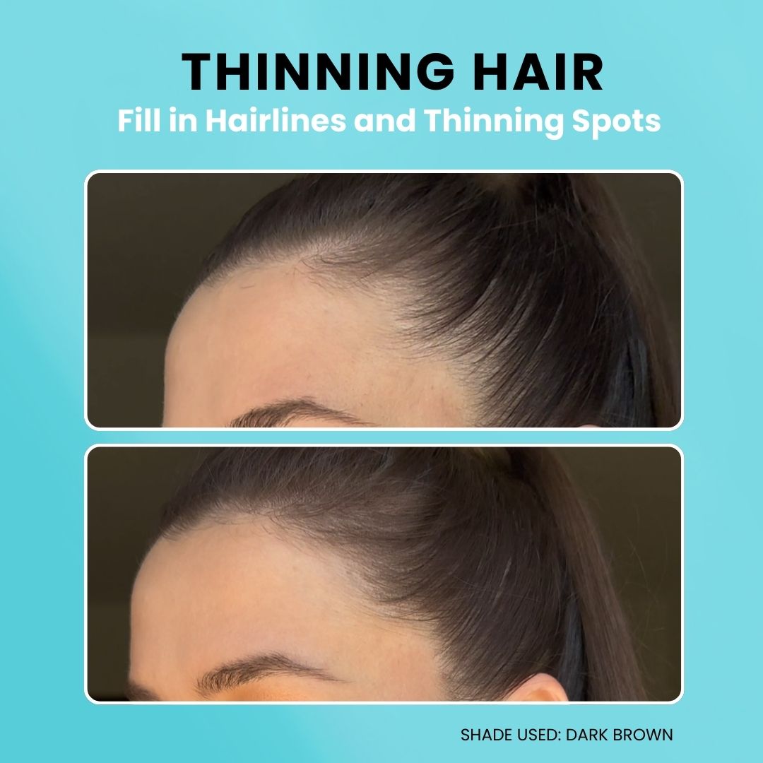 Before and after using SURETHIK Hairline Powder to conceal a thinning hairline and sparse areas.