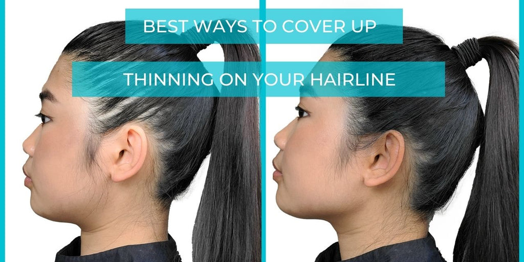 10 Best Hair Loss Concealers  Hair Fibers For Thinning Hair