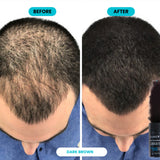 SURETHIK Hair Fibers for Thinning Hair 30g