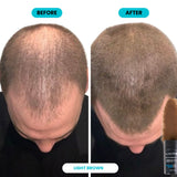 SURETHIK Hair Fibers for Thinning Hair 30g