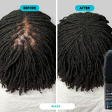 SURETHIK Hair Fibers for Thinning Hair 30g