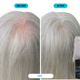 SURETHIK Hair Fibers for Thinning Hair 30g