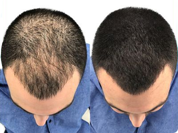 Hair Thickening Fibers (15g / 0.53oz) image 1