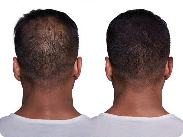 Hair Thickening Fibers (15g / 0.53oz) image 2