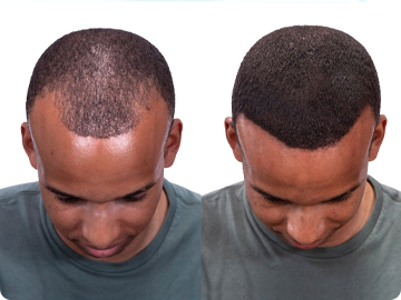 Hair Thickening Fibers (30g / 1.06oz) image 3