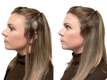 New! 4 in 1 Hairline Powder image 3