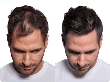 Hair Thickening Fibers (30g / 1.06oz) image 4