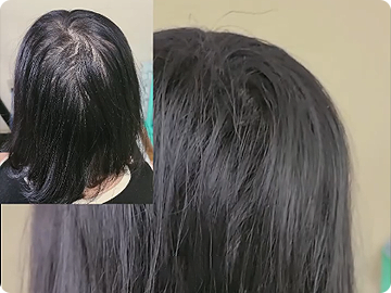 SureThik® Hair Thickening Fibers (30g / 1.06oz) image 1