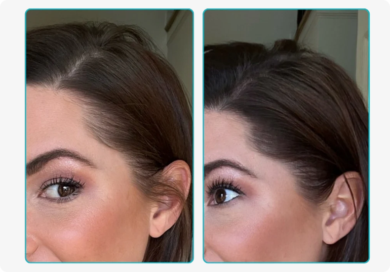 Conceal Hair Thinning