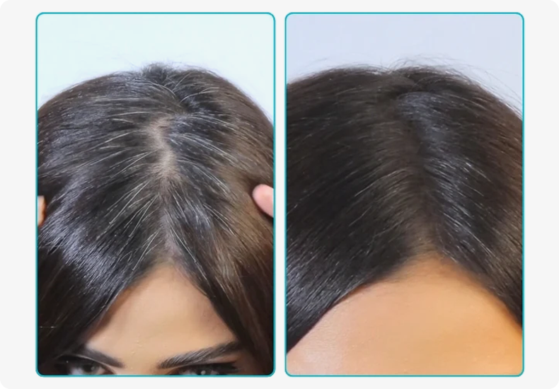 Cover Greys & Regrowth