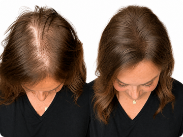 Hair Thickening Fibers (30g / 1.06oz) image 1