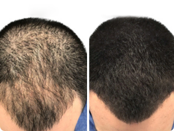 SureThik® Hair Thickening Fibers (30g / 1.06oz) image 2