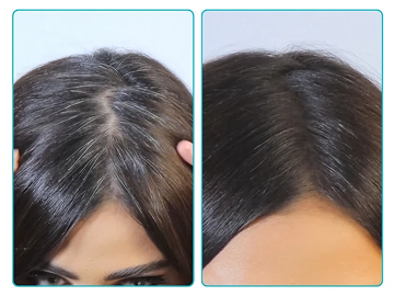 New! 4 in 1 Hairline Powder image 2