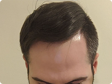 SureThik® Hair Thickening Fibers (30g / 1.06oz) image 3