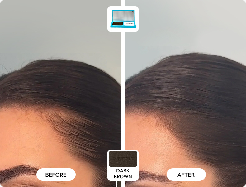 Great for my thinning areas!