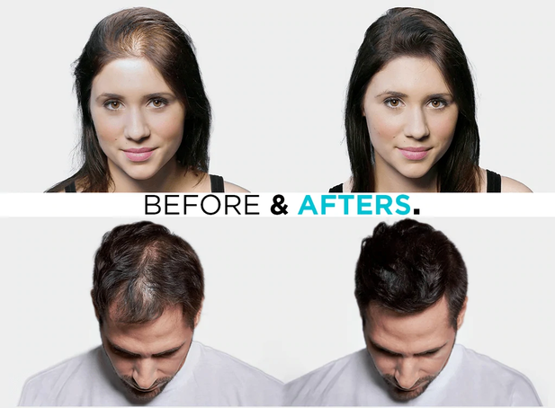 THICK FIBER  Hair Building Fibers  Thinning Hair  Hair loss concealer