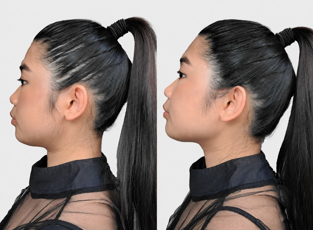 Before and after of a woman with a ponytail using SURETHIK hair fibers