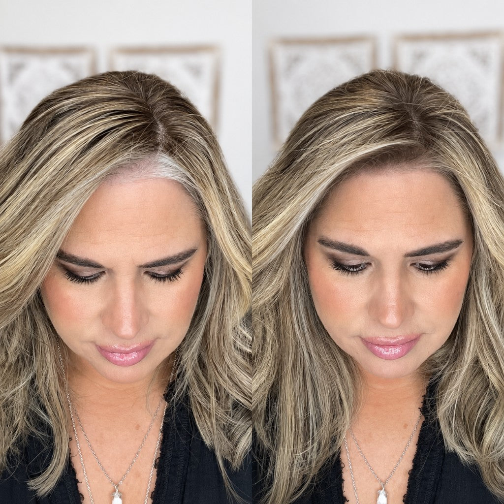 Before and after of a blonde woman looking down after using SURETHIK