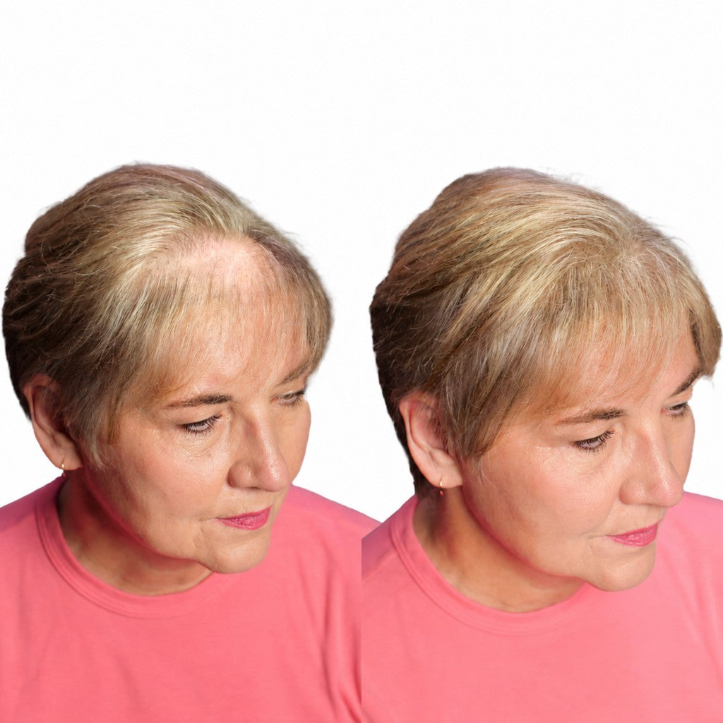 Before and after of an older blonde woman in a pink shirt using SURETHIK hair fibers